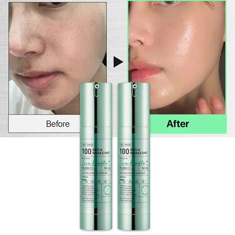Retinol Vitamin A Serum