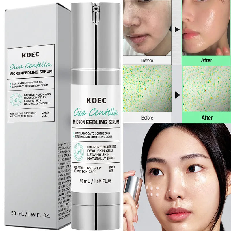 Korean Microneedle Collagen Essence