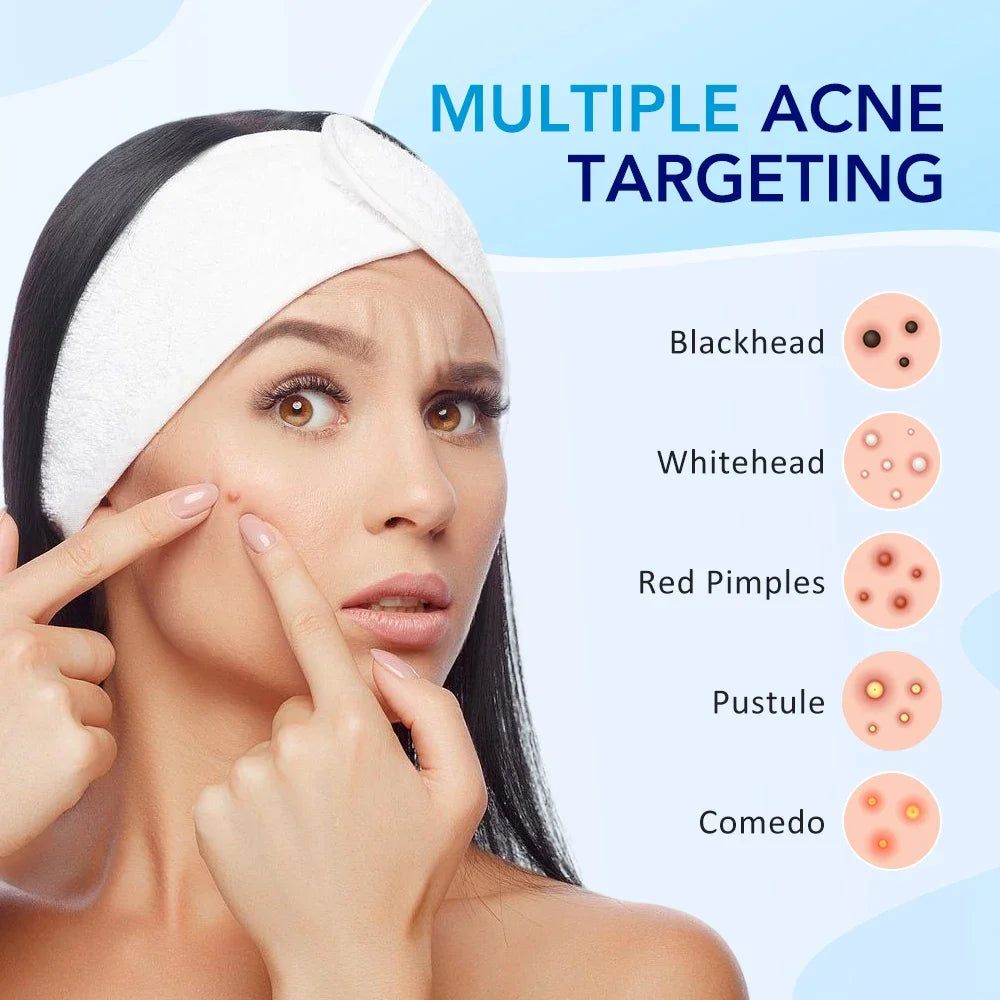 LUXE LINE Invisible Acne Patches – 180 or 360 Pcs