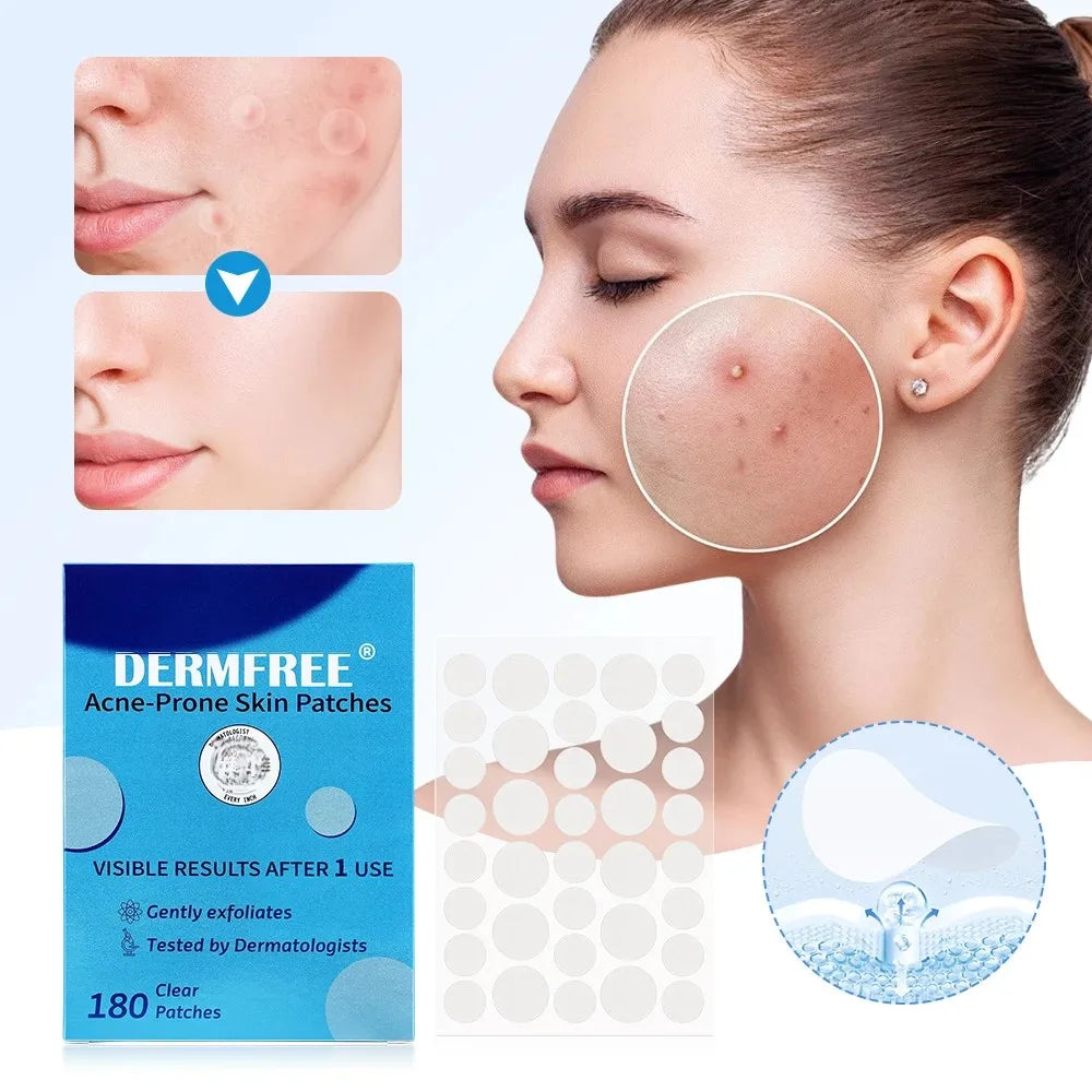 LUXE LINE Invisible Acne Patches – 180 or 360 Pcs
