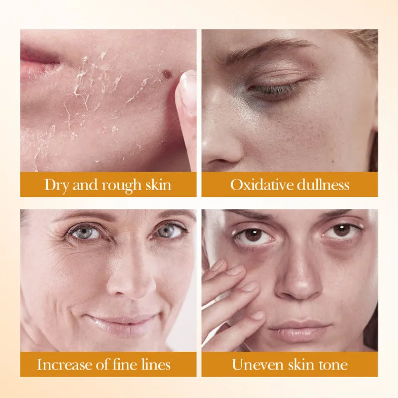 Rice Whitening Skincare Set (5pcs)