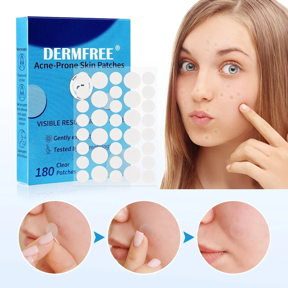 LUXE LINE Invisible Acne Patches – 180 or 360 Pcs