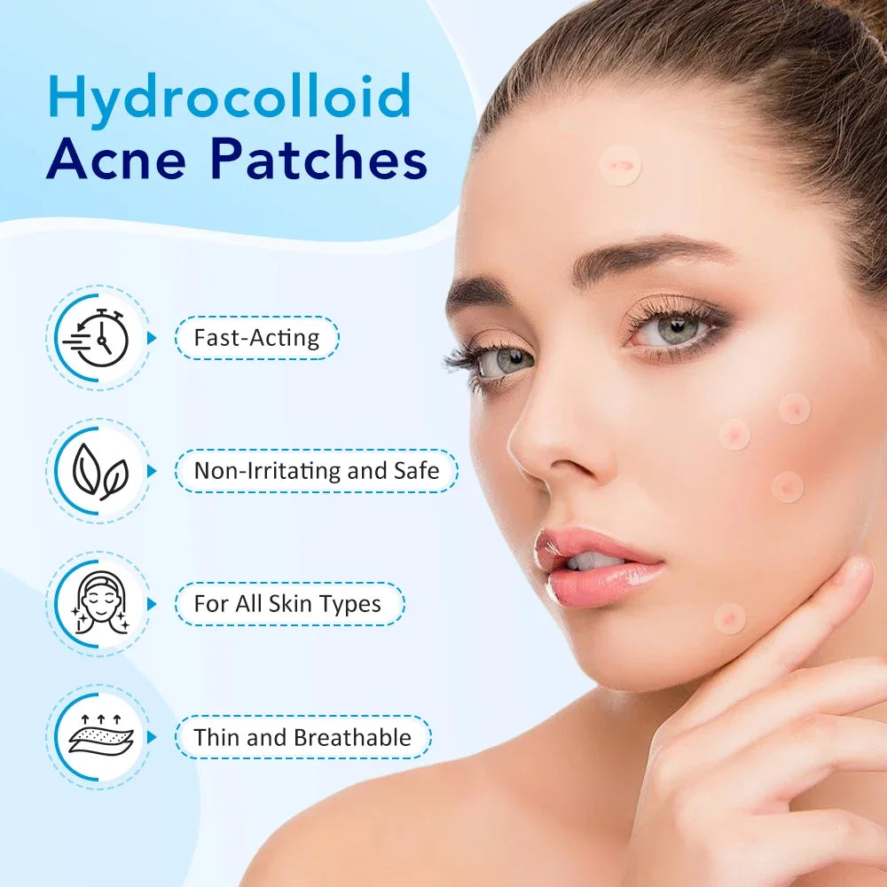 LUXE LINE Invisible Acne Patches – 180 or 360 Pcs