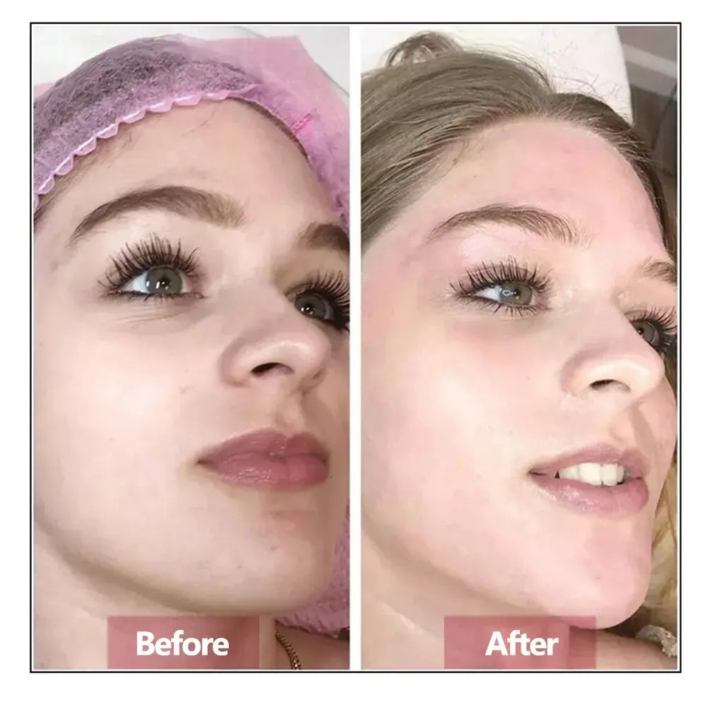 Hyaluronic Acid Repair & Firming Serum